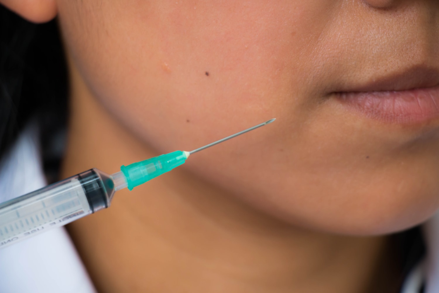 Botox Dentistry